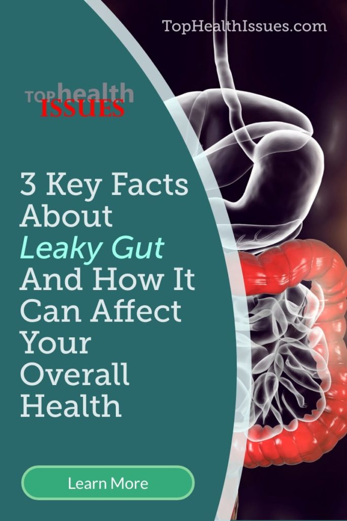 3 Key Facts About Leaky Gut And How It Can Affect Your Overall Health