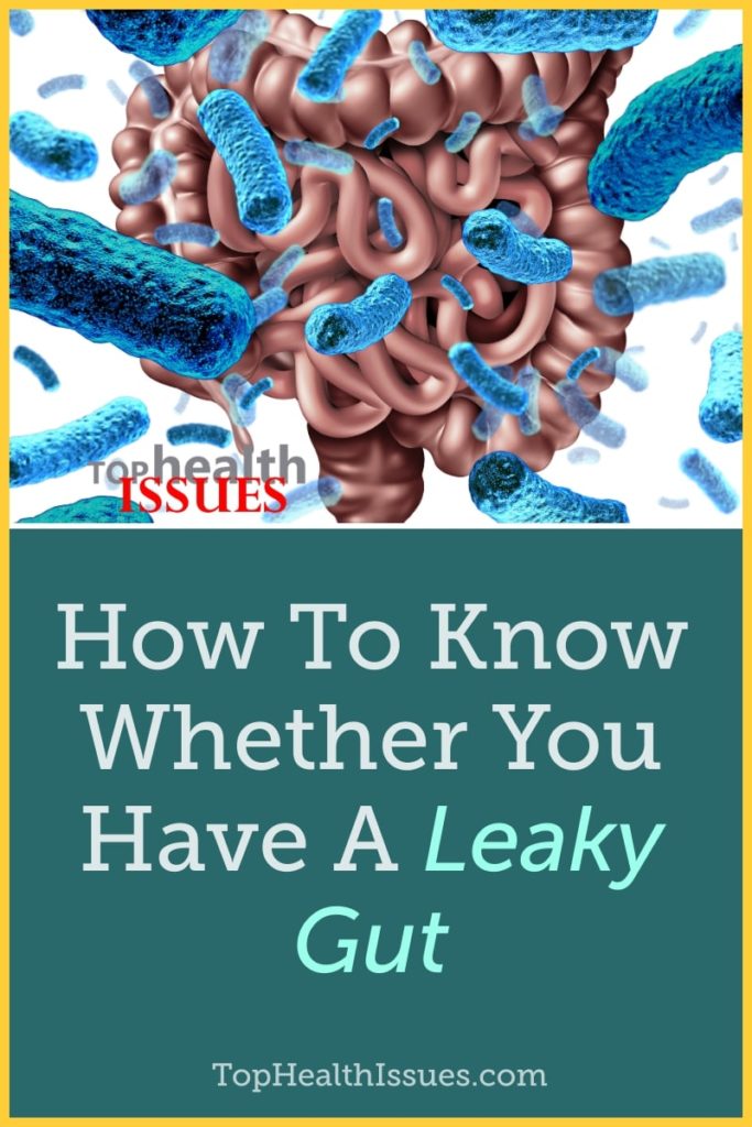 How To Know Whether You Have A Leaky Gut