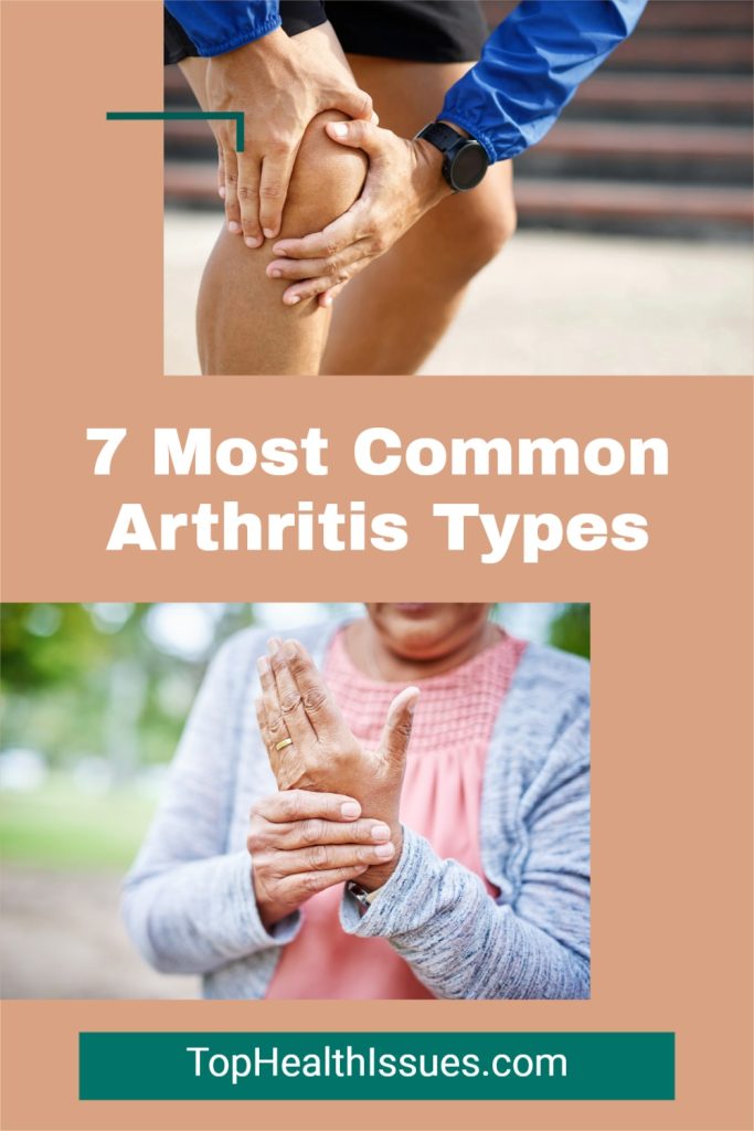 7 Most Common Arthritis Types